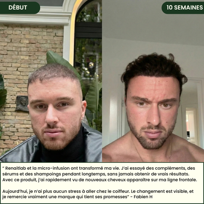 Système Capillaire Micro-infusion renaitlab® Homme
